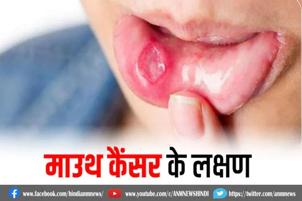 मुंह का कैंसर क्या है?