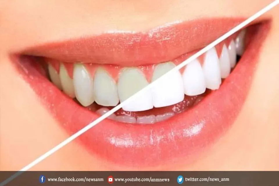 दांतों का रखे खास ख्याल