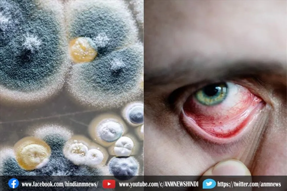 जानिए, क्या है ब्लैक फंगस