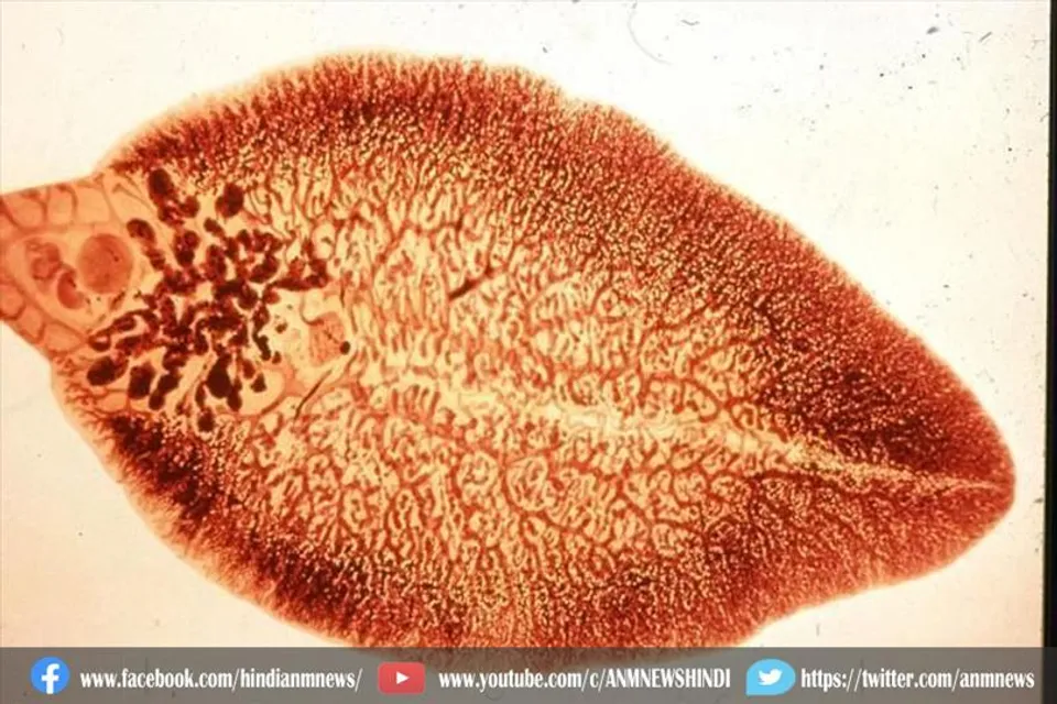 जानवरों के लिवर में पाया जाता फ्लैट वर्म बीमारी, अब इंसानो में भी मिला