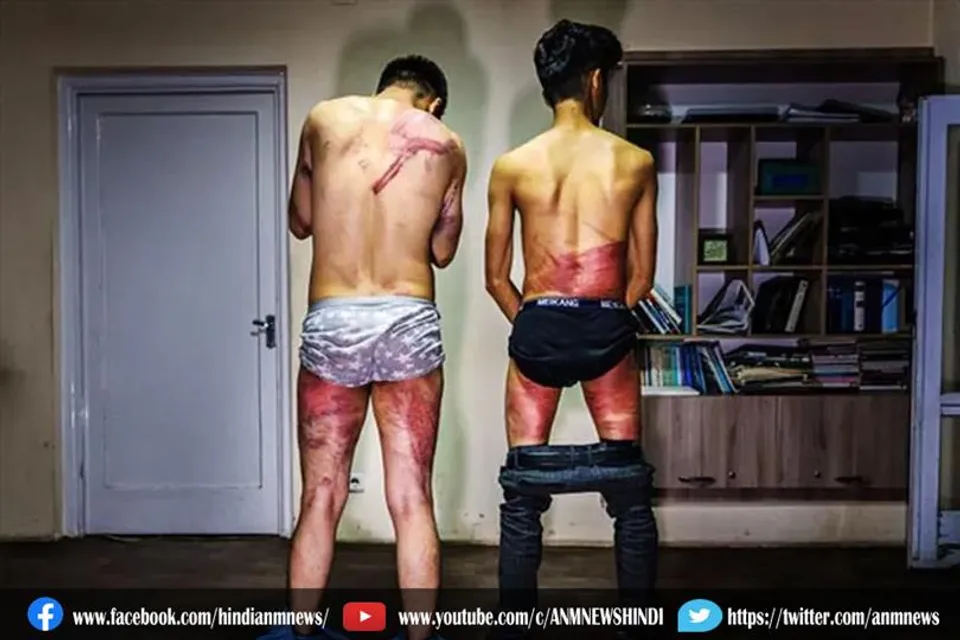 खौफनाक सच्चाई: तालिबान ने पत्रकारों को मार-मारकर उतारी खाल