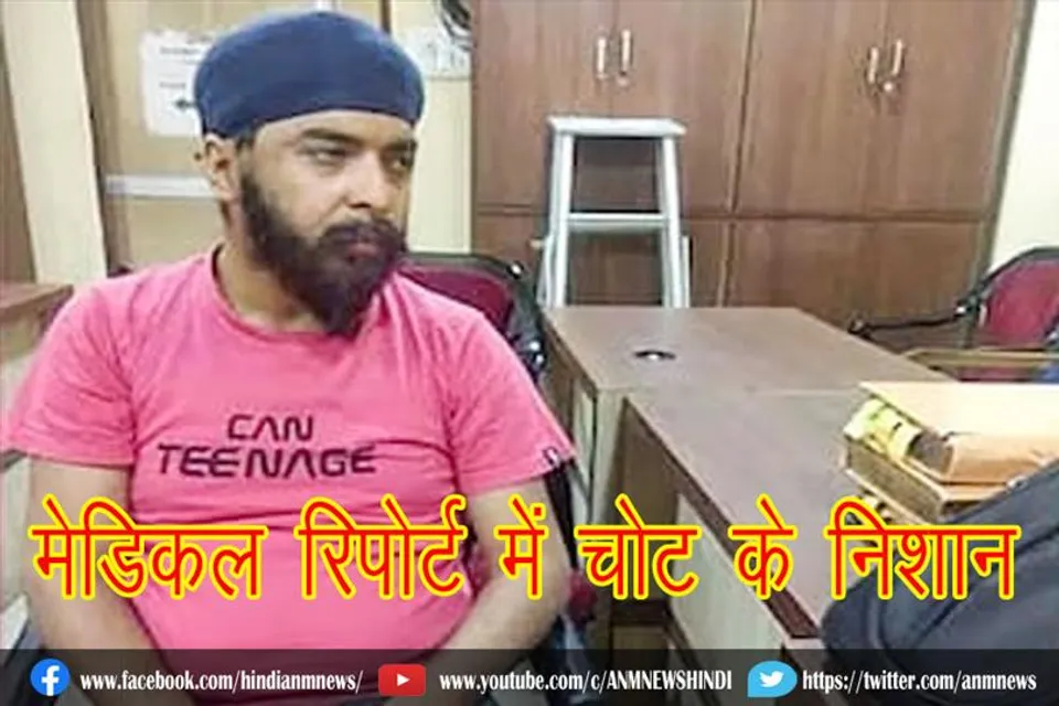 तेजिंदर बग्गा की मेडिकल रिपोर्ट में चोट के निशान