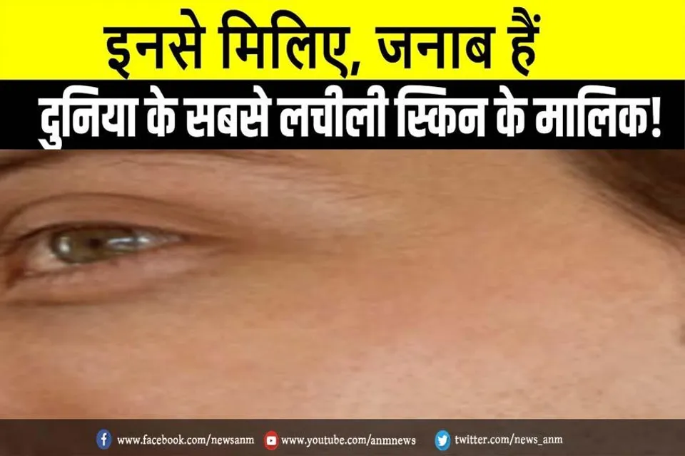 देखे वायरल तस्वीरें: इनसे मिलिए, जनाब हैं सबसे लचीली स्किन के मालिक