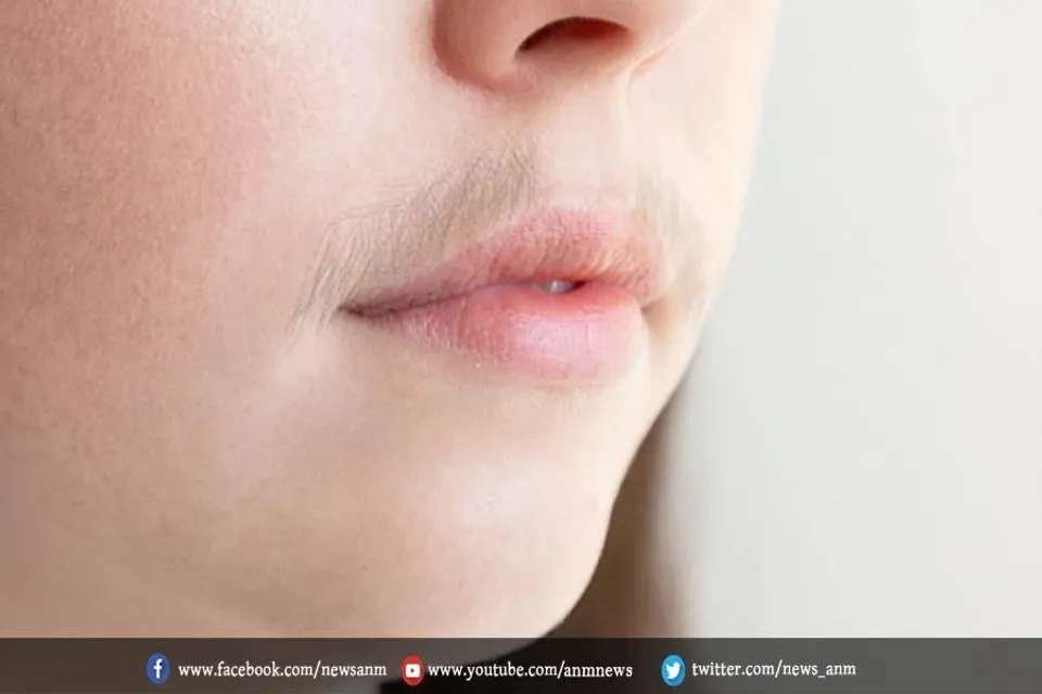 चेहरे के बालों को हटाने में सहना पड़ता हैं दर्द, तो आजमाएं ये घरेलू नुस्खे