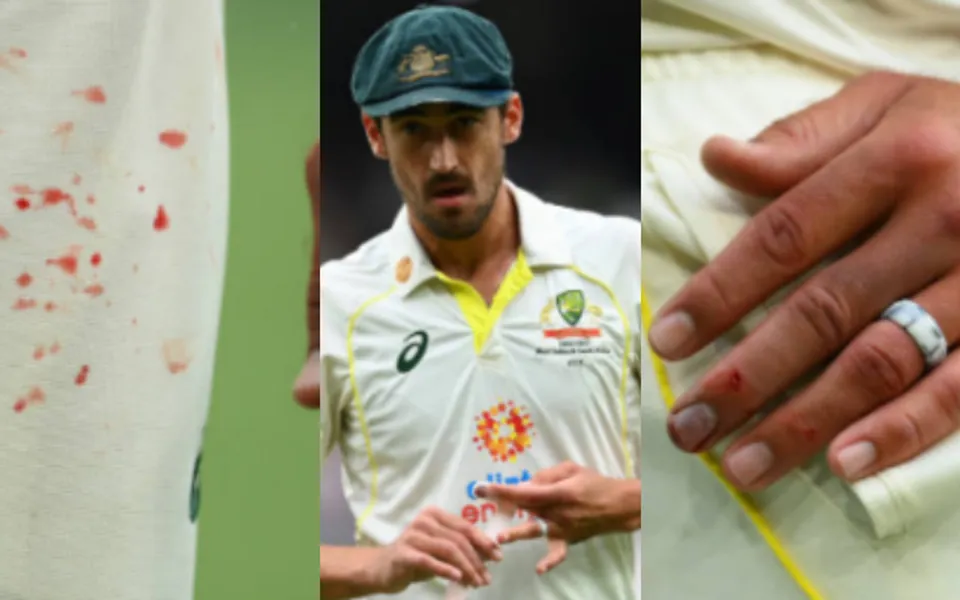 Mitchell Starc