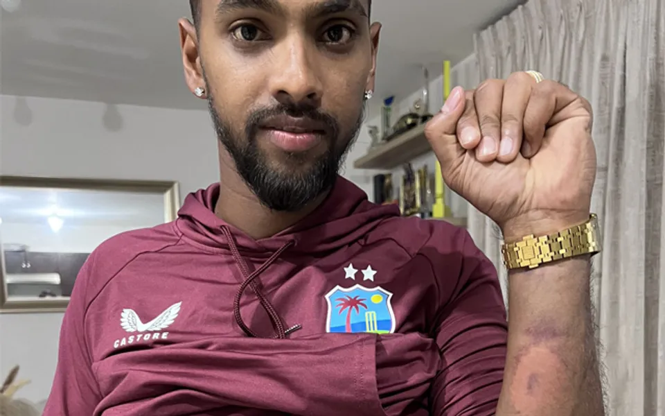Nicholas pooran