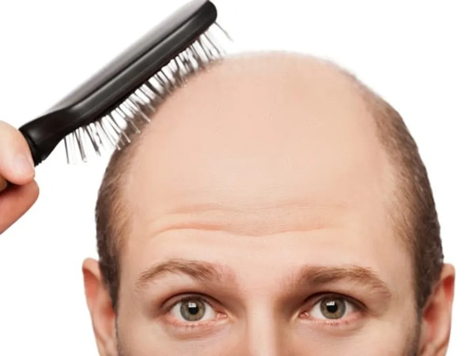 Say no to hair fall, Yes to Hair care