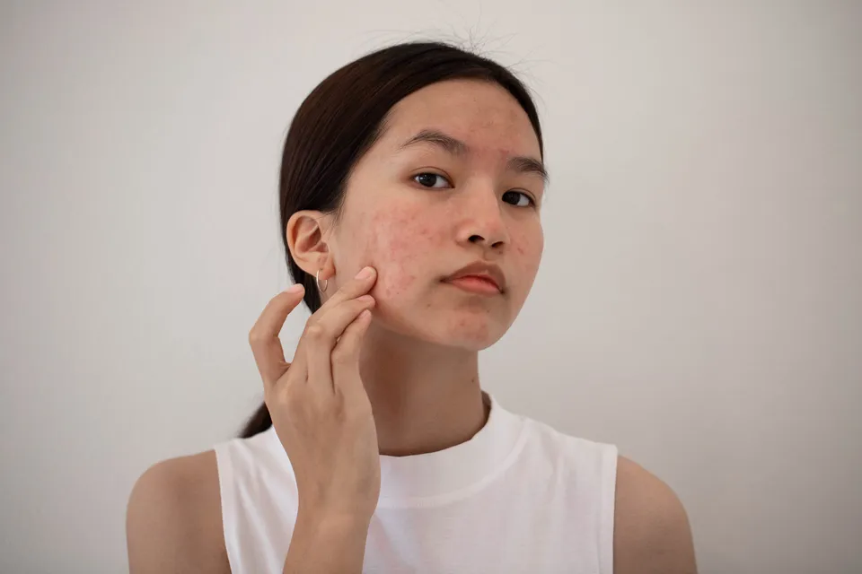 Here's What Experts Had To Say About Psychodermatology, The Practice That Blends Skincare With Wellbeing