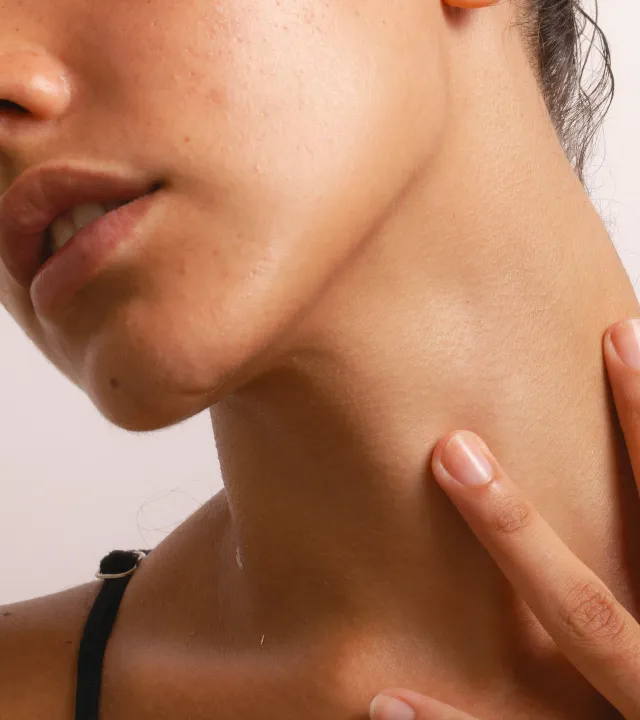 A zoomed-in shot of a woman's face and neck with a damaged skin barrier