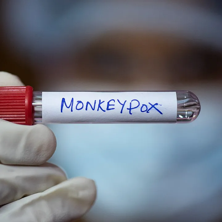 The perils of viewing monkeypox as a â€˜gay diseaseâ€™