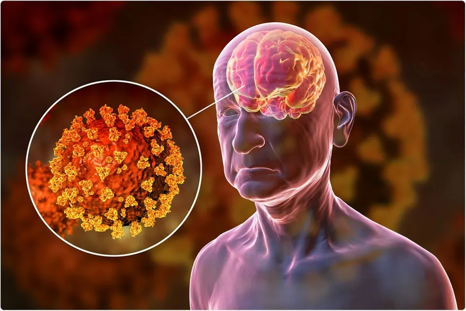 Brain cells covid19.jpg