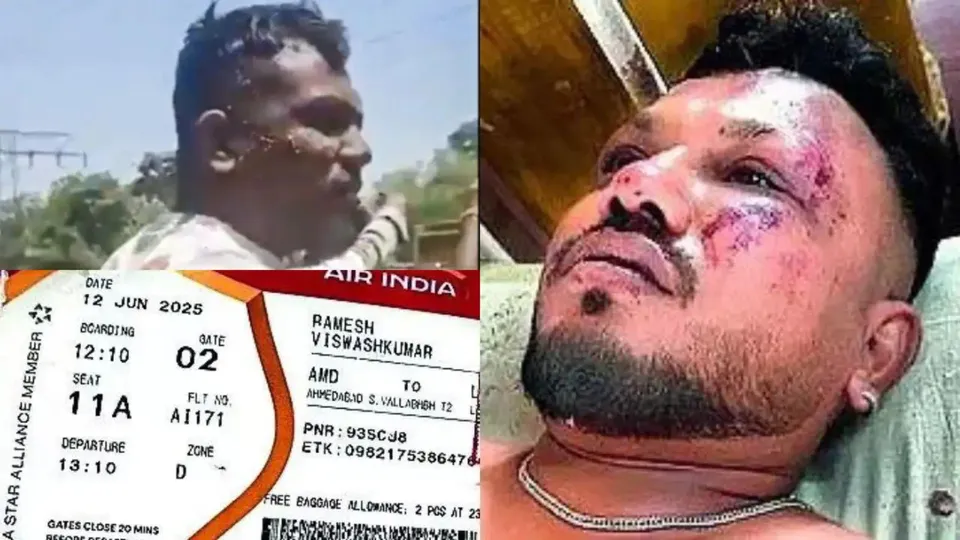 11A Ramesh Vishwakumar Air India Plane Crash