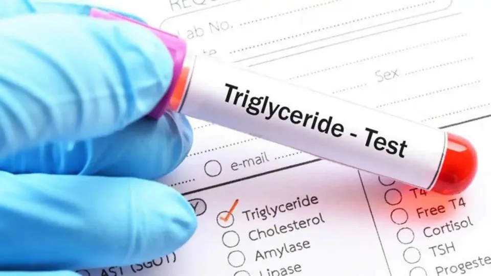 High Triglycerides Cholesterol