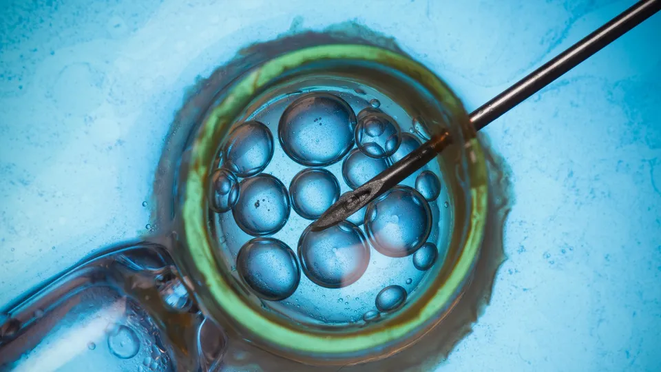 assisted reproduction technology.jpg