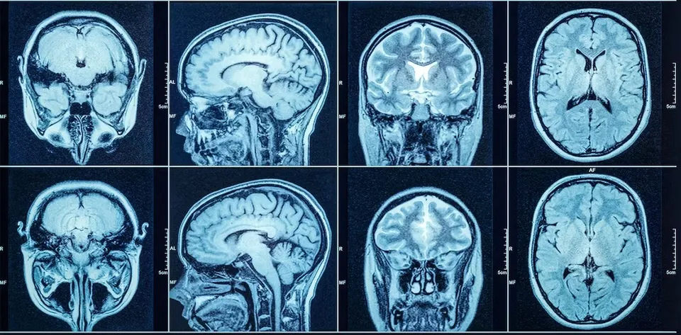Long covid organ abnormalities.jpg