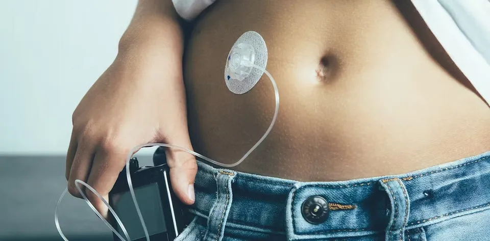 Medical implants.jpg