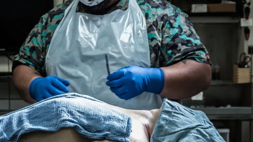 autopsy