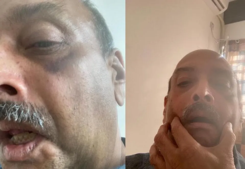 When Choksi appeared in Dominica battered and bruised