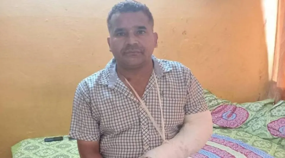Sub Inspector Medhalal who sustained a bullet injury in the clashes in Jahangir Puri on Sunday