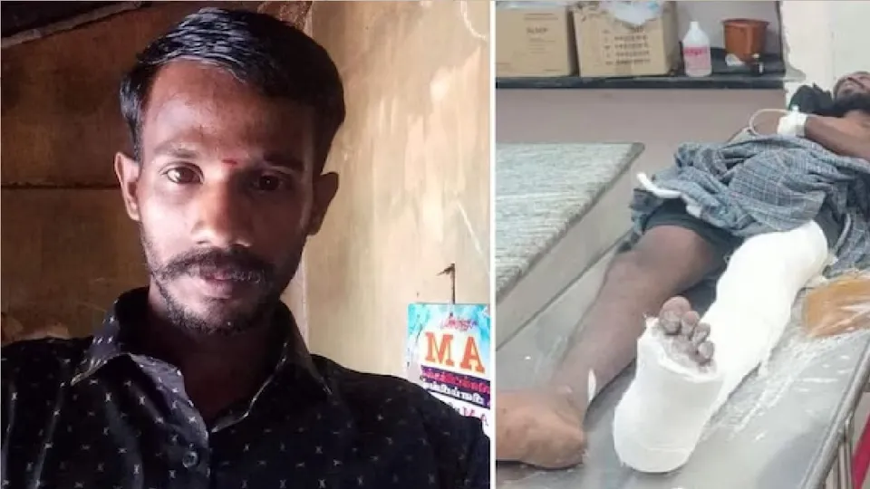 Serial offender breaks leg when trying to escape