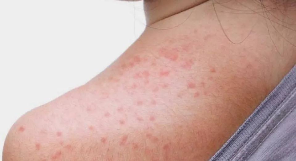 ea5bd416-36c0-45e1-a46c-3a54b6db383b