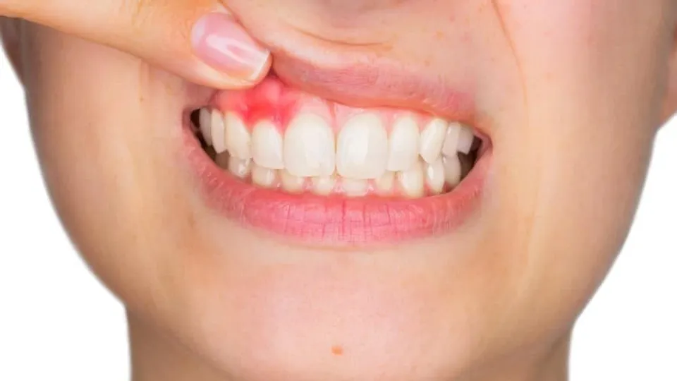 718b54b9-acd1-4d4b-9d85-ade1d84594a1