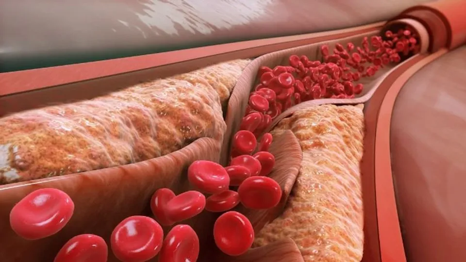 w-1280,h-720,format-jpg,imgid-01gyhw3cw3gvkd0jpenae041cm,imgname-fotojet---2023-04-21t174657-818