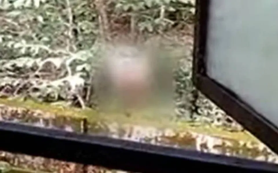 നഗ്നതാ പ്രദര്‍ശനം ഒരു മാനസിക രോഗമോ? ചികിത്സയുടെ പ്രാധാന്യം