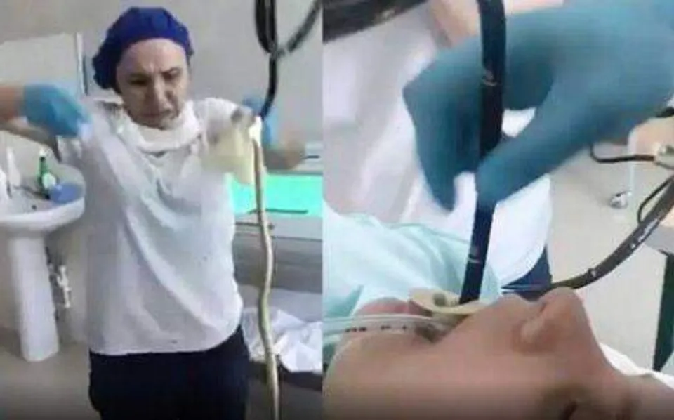 സ്ത്രീയുടെ വായിലൂടെ പുറത്തെടുത്തത് നാലടിയോളം നീളമുളള പാമ്പിനെ; ഞെട്ടിത്തരിച്ച് നഴ്‌സ്