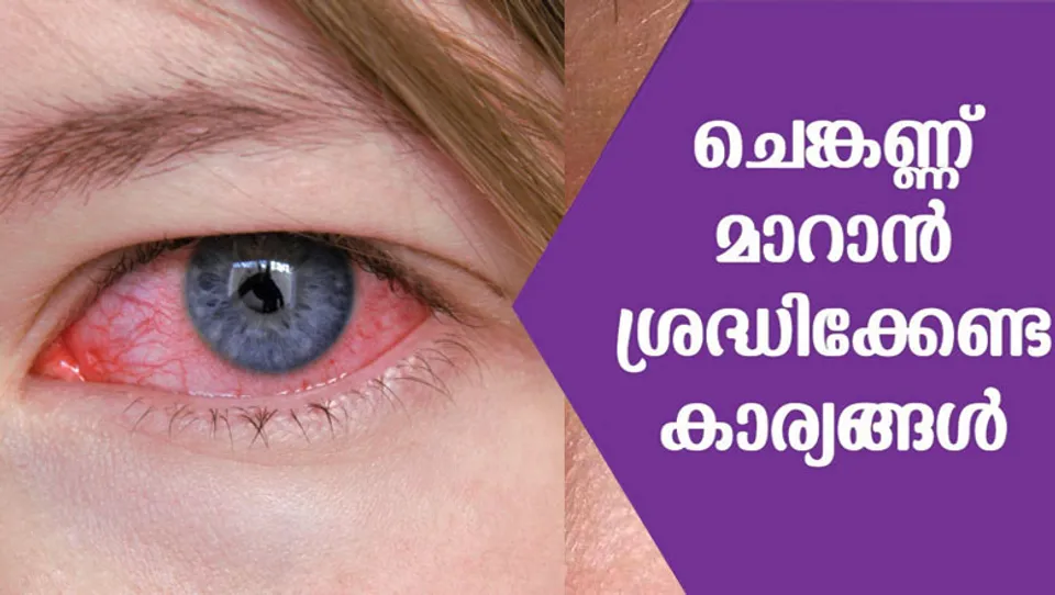 ചെ​ങ്ക​ണ്ണ്; ചൂ​ടു​വെ​ള്ള​ത്തിലെ കു​ളി​ ഒഴിവാക്കുക; ഭക്ഷണത്തിൽ ഒഴിവാക്കേണ്ടതെന്തെല്ലാം…