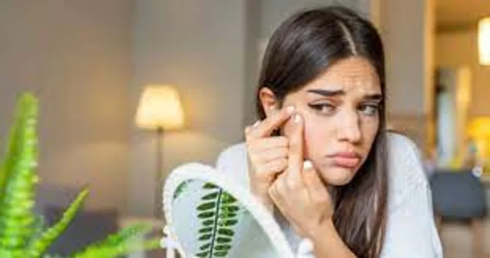 എണ്ണമയമുള്ള ചർമ്മമുള്ളവർ ഡയറ്റില്‍ ഉള്‍പ്പെടുത്തേണ്ട ചില ഭക്ഷണങ്ങള്‍ എന്തൊക്കെയാണെന്ന് നോക്കാം...