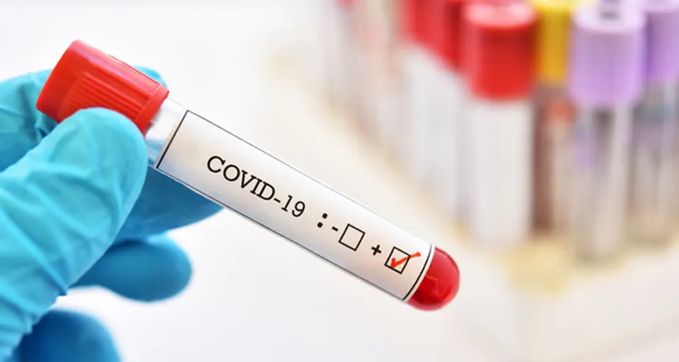 ആന്ധ്രാപ്രദേശില്‍ ഇന്ന് 6,133പേര്‍ക്ക് കോവിഡ് സ്ഥിരീകരിച്ചു; 7,075പേര്‍ രോഗമുക്തരായി