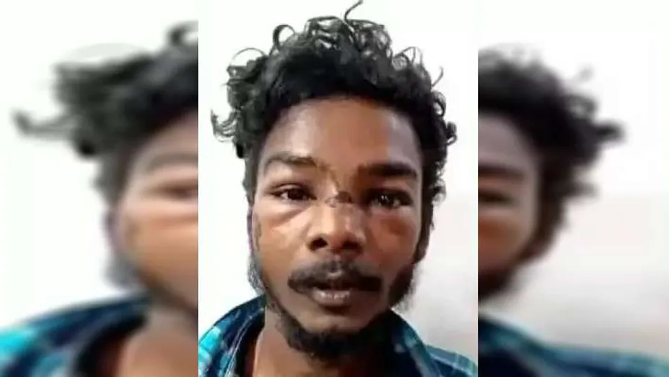 കുടുംബ വഴക്ക് : കൊല്ലം പാരിപ്പള്ളിയിൽ ഭാര്യാപിതാവിനെ കുത്തിക്കൊലപ്പെടുത്താന്‍ ശ്രമിച്ചയാള്‍ അറസ്റ്റില്‍