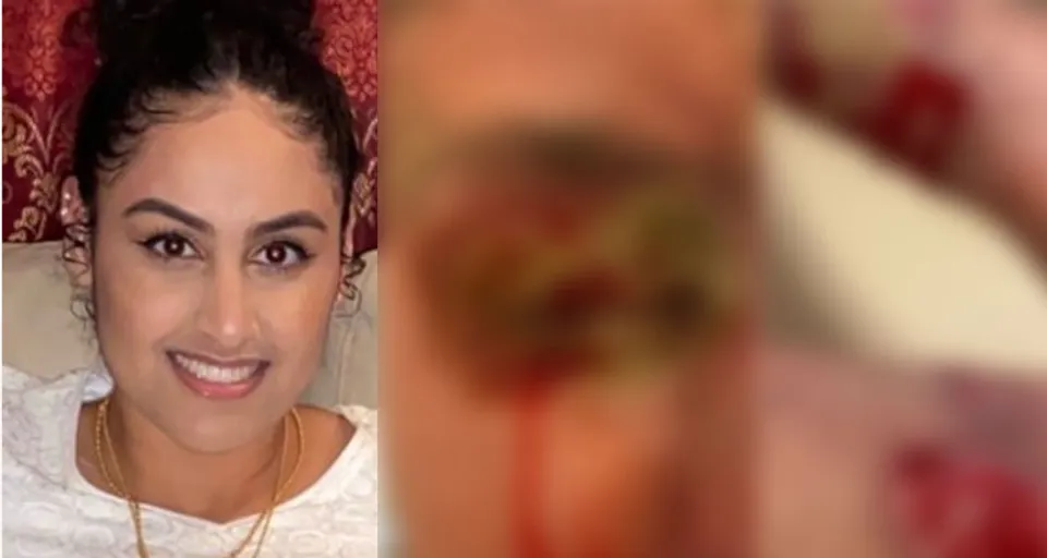 മെഡിക്കല്‍ വിദ്യാര്‍ഥിനിയെ ആസിഡ് ഒഴിച്ച് പരിക്കേല്‍പിച്ച പ്രതിയെ കണ്ടെത്തുന്നതിന് പാരിതോഷികം പ്രഖ്യാപിച്ചു