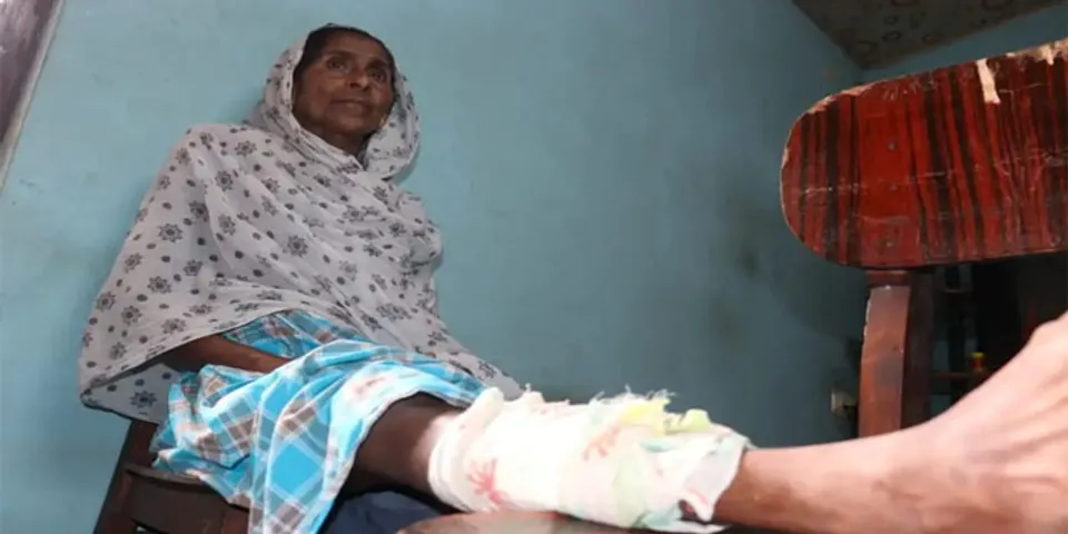 പള്ളിശ്ശേരിക്കലിൽ വയോധികയ്ക്ക്‌ പേപ്പട്ടിയുടെ കടിയേറ്റു; ശാസ്താംകോട്ട തടാക തീരത്ത് കുടുംബത്തെ കടിച്ച നായ എന്ന് സംശയം:നായ പിന്നീട് ചത്തു