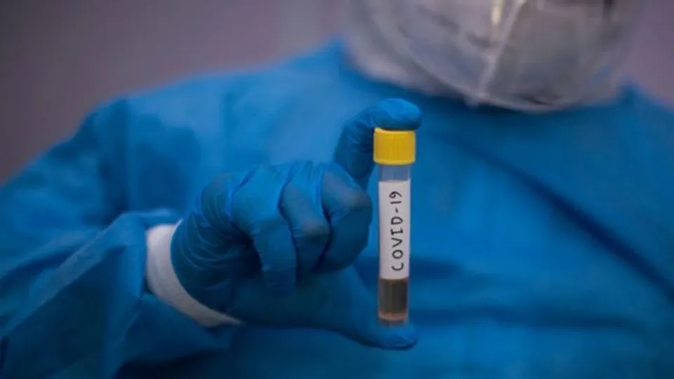 കോവിഡ് കാലത്തിനെ അതിജീവിക്കാം.........