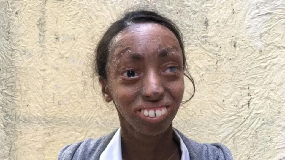 നിഷയുടെ സ്വപ്നങ്ങളിലെ നക്ഷത്രത്തിളക്കം..!!  മാതാപിതാക്കൾ തെരുവിൽ ഉപേക്ഷിച്ചു കടന്നുകളഞ്ഞ നിഷ ഒരു സാഹസിക മുന്നേറ്റത്തിന്റെ പ്രതീകമാണ്