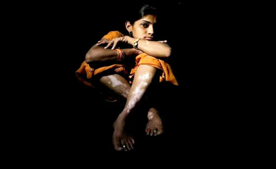 "സ്നേഹത്തിന്‍റെ വെള്ളപ്പാണ്ടുകൾ"  അച്ചു വിപിന്‍ .