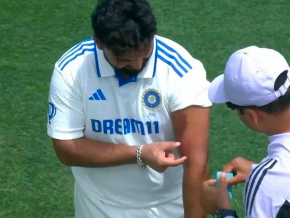 Rishabh Pant gets hits on his arm 