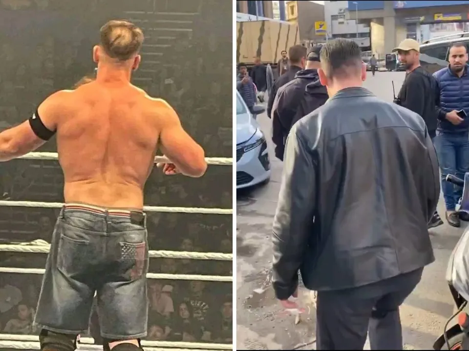 Has John Cena gotten rid of his bald spot?