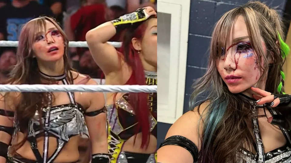 Kairi Sane has solitary emoji update on her eye injury from WWE Raw