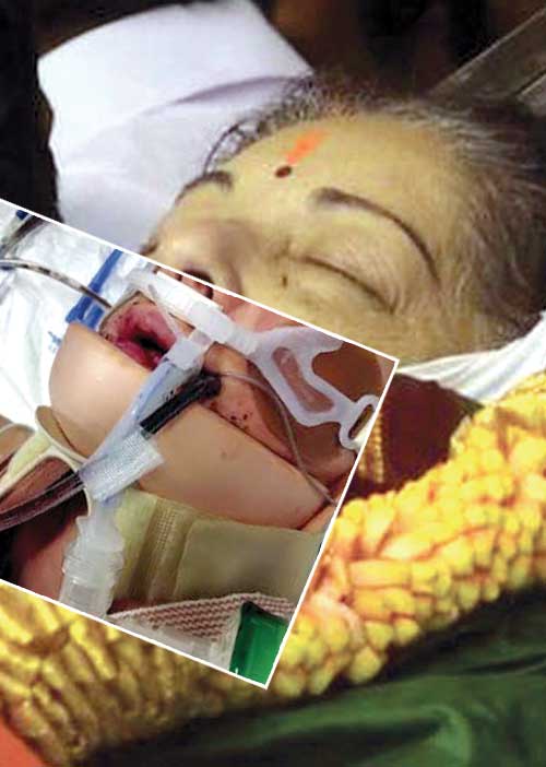 செத்த பிறகு லப்... டப்... ஜெ.வைக் காப்பாற்றி இருக்கலாம்! மரணத்தில் புது மர்மம்!