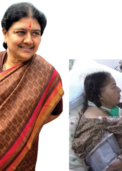 ராங்கால் ஜெவுடன் சசி! ரெடியாகும் அப்போலோ வீடியோ! நீதிமன்றத்தில் குற்றப்பத்திரிகை! சட்டமன்றத்தில் வெள்ளை அறிக்கை! -அலறும் மாஜிகள்!