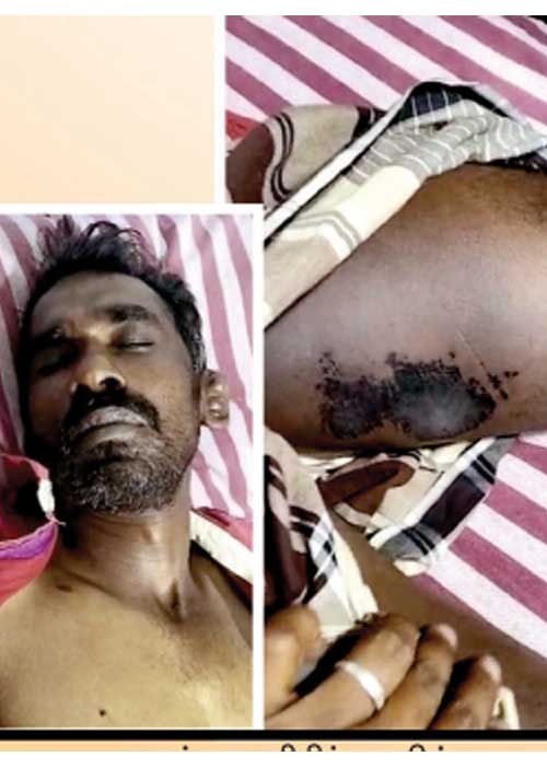 போலீஸ் வெறித் தாக்குதல்! நாகர்கோயிலிலும் ஒரு ’அம்பாசமுத்திரம்!