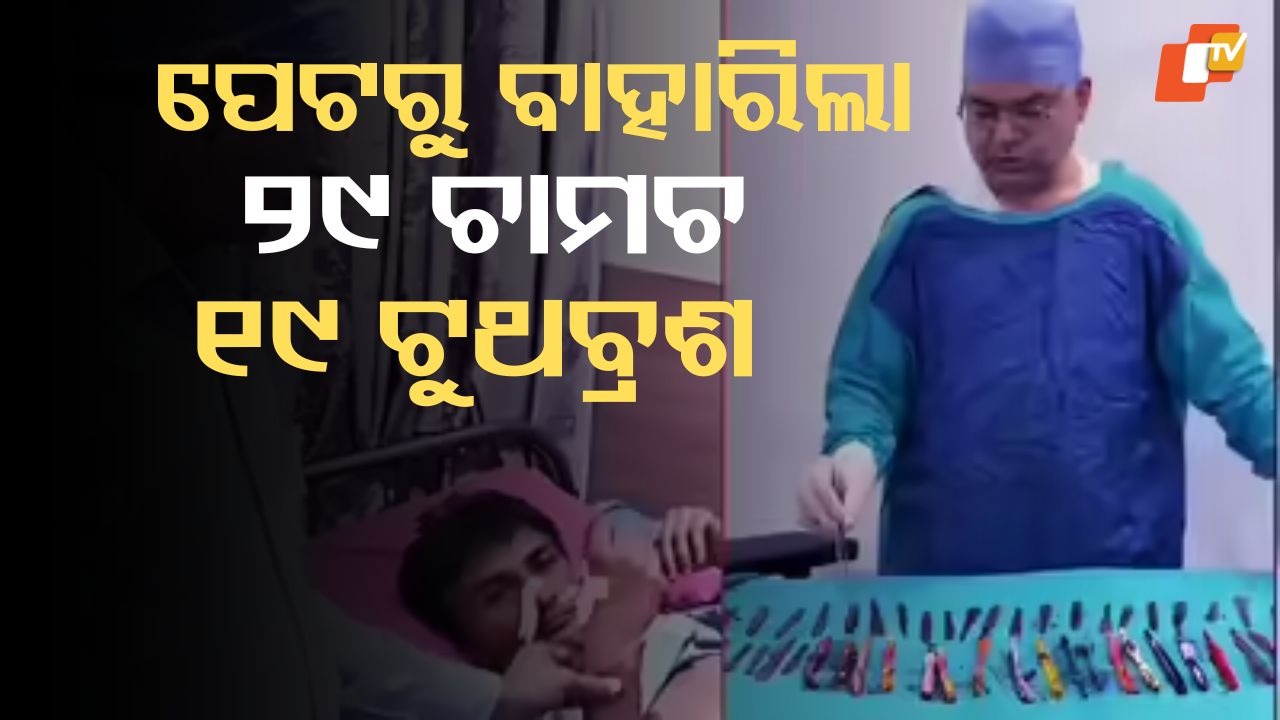 Unusual Disorder Causes Patient to Consume Spoons: ପେଟରୁ ବାହାରିଲା ୨୯ଟି ଚାମଚ, ୧୯ଟି ଟୁଥବ୍ରଶ ଓ ୨ଟି କଲମ; ଏହି ଅଜବ ରୋଗ ଯୋଗୁଁ ସେସବୁ ଖାଇଦେଇଥିଲେ