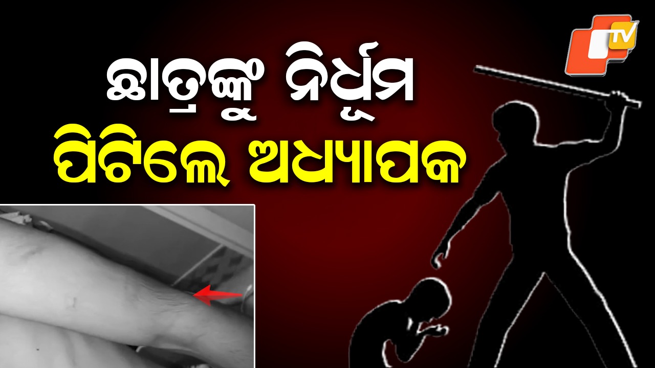Student Allegedly Beaten by Lecturer: ଅଧ୍ୟାପକଙ୍କ ମାଡ଼ରେ ଲହୁଲୁହାଣ ଛାତ୍ର, ଥାନାରେ ଏତଲା ଦେଲେ ପରିବାର