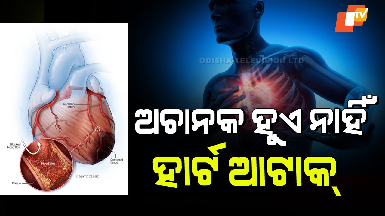 How To Protect Your Heart: ଅଚାନକ ହୁଏ ନାହିଁ ହାର୍ଟ ଆଟାକ୍! ଛୋଟ ଛୋଟ ଅଭ୍ୟାସ ଆପଣଙ୍କ ହୃଦୟକୁ ରକ୍ଷା କରିଦେବ