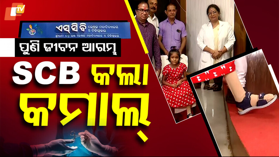 From Tragedy to Triumph: ନିଜ ପାଦରେ ଚାଲିଲା କୁନିଝିଅ, କମାଲ୍‌ କଲା SCB ମେଡିକାଲ୍‌‌...