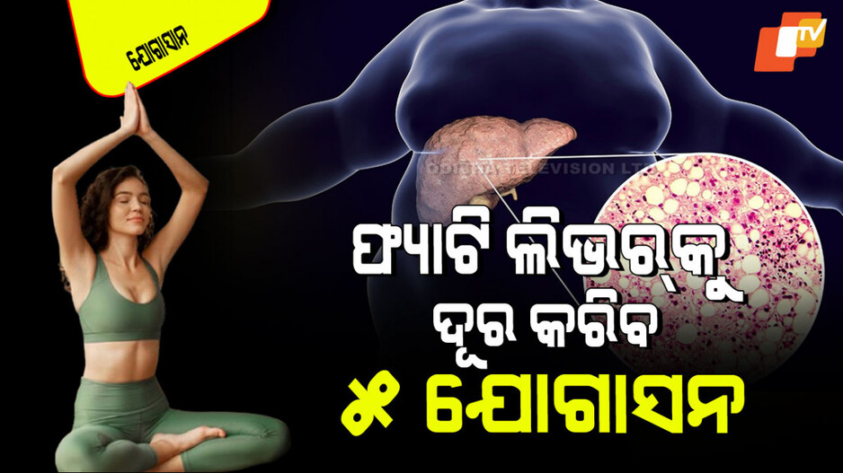 Yogasana: କରନ୍ତୁ ଏହି ୫ ସହଜ ଯୋଗାସନ; ଜୀବନରେ ହେବ ନାହିଁ ଫ୍ୟାଟି ଲିଭର୍‌