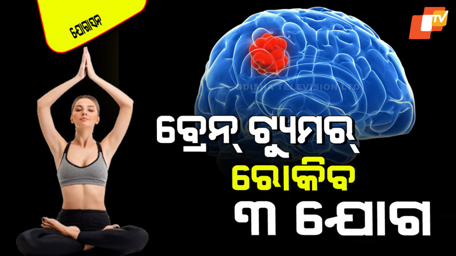 Yogasana: ବିଶ୍ୱ ପାଇଁ ଚିନ୍ତାରେ କାରଣ ହୋଇଛି ବ୍ରେନ୍ ଟ୍ୟୁମର୍‌; ୩ ଯୋଗ, ଦେବ ମୁକ୍ତି